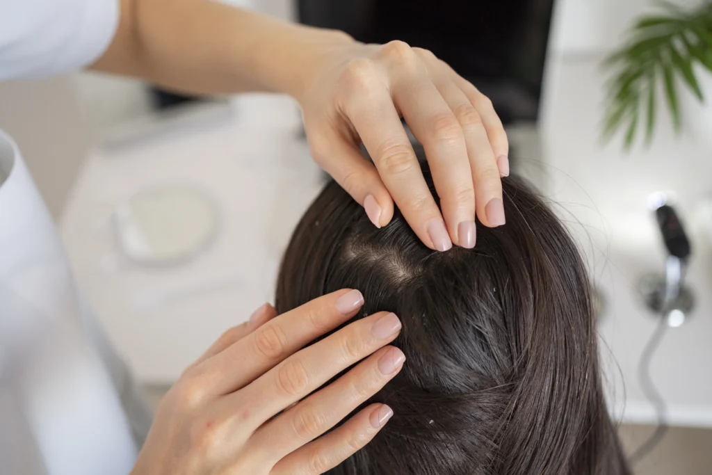 10 Quick Ways to Reduce Hair Loss Starting Today